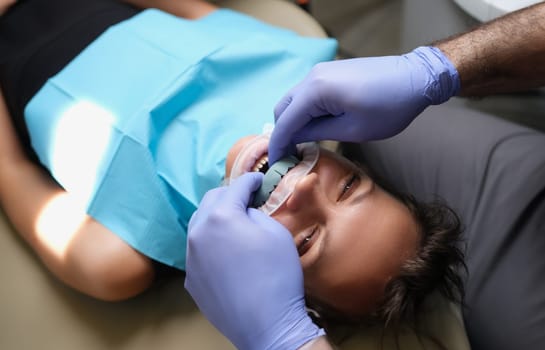 Woman with dental cast veneer on upper jaw in dentistry. Orthodontic treatment in dentistry, prosthetics and veneers.