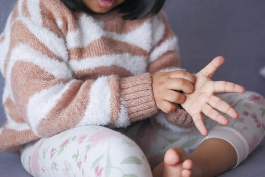 child suffering from itching skin on hand .