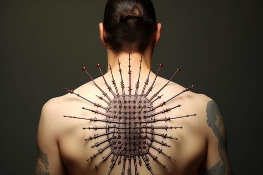 Relieving Acupuncture treatment. Medicine care body. Generate Ai