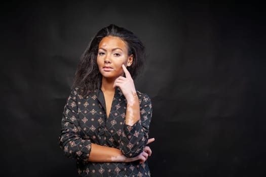 Confident African American woman with Vitiligo pigmentation skin problem. Portrait of beautiful young lady with black hair confidently looking at camera. Girl is standing on black background.