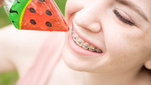 Beautiful young woman with braces on her teeth eats a watermelon-shaped lollipop outdoors