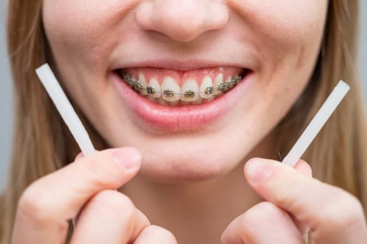 Close-up portrait of a woman with braces using special orthodontic wax