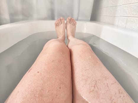 Close-Up of Varicose Veins on a Leg in the Bathtub. Leg with varicose veins while submerged in bathtub, highlighting the health condition