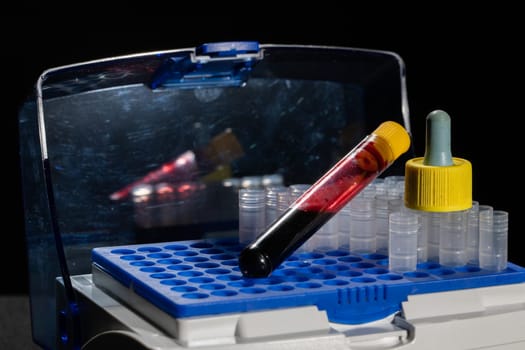 Each blood vial is transported to the laboratory for specialized tests.