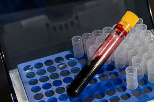 Each blood vial is transported to the laboratory for specialized tests.