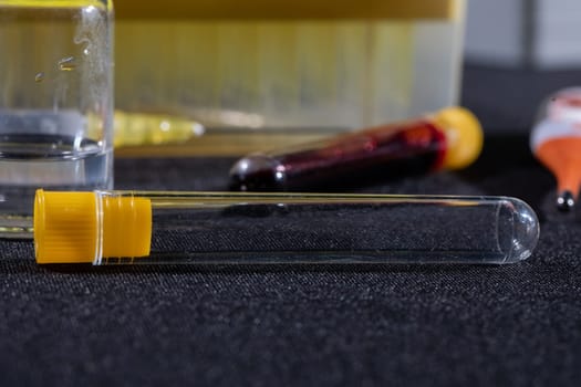 Each blood vial is transported to the laboratory for specialized tests.