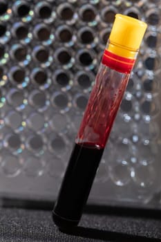 Each blood vial is transported to the laboratory for specialized tests.