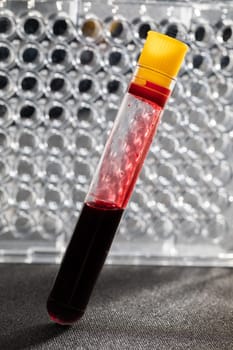 Each blood vial is transported to the laboratory for specialized tests.
