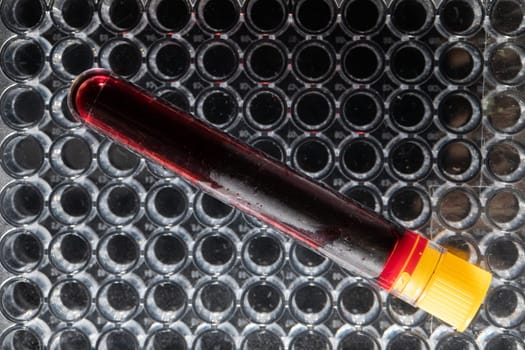 Each blood vial is transported to the laboratory for specialized tests.