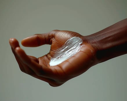 Close-up of a hand applying healing cream on dry skin, representing skincare and health.