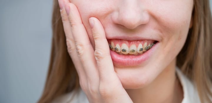 Close-up portrait of a red-haired girl suffering from pain due to braces. Young woman corrects bite with orthodontic appliance