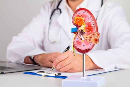 mockup kidney on work desk of doctor