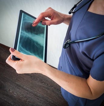 Shot of the female doctor in uniform against the white wall studying x-ray image of the lungs on the tablet