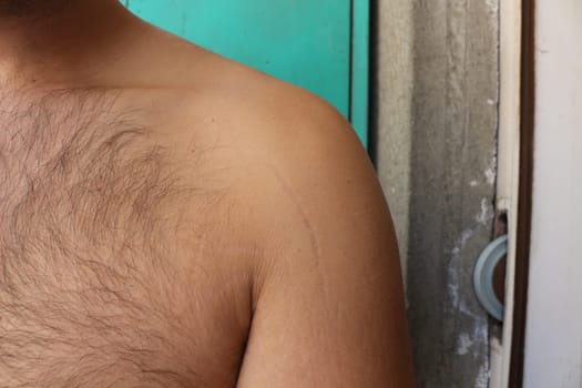 self-acceptance and care as you explore the topic of stretch marks on a man's arms and chest