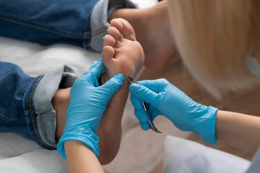 Professional removing a callus on a womans foot by nippers at clinic.