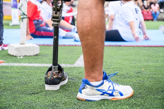 Unrecognizable male athlete with a prosthetic leg