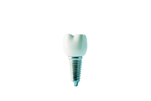 Dental Implant Procedure Implant Supported Teeth. Generative AI.