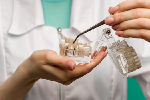 Woman dentist showing on a jaw model oral checkup - image