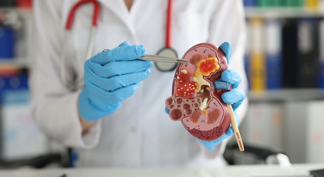 Urology and treatment of kidney diseases. Doctor performing a kidney examination on a female patient with kidney disease