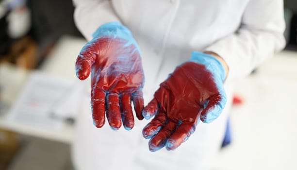 Surgeon in blue gloves with blood. Evaluation of severity of blood loss in surgical practice concept