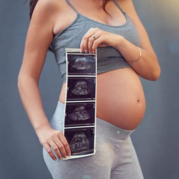 Mother, pregnancy and ultrasound in studio with belly for gender reveal, album and baby shower. Woman, child and sonogram isolated on gray background for maternity shoot, surrogacy and adoption.