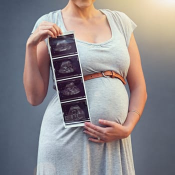 Woman, pregnant and child ultrasound in studio for maternity shoot, album and baby shower. Mother, expecting and sonogram isolated on gray background for gender reveal, surrogacy and legal adoption.
