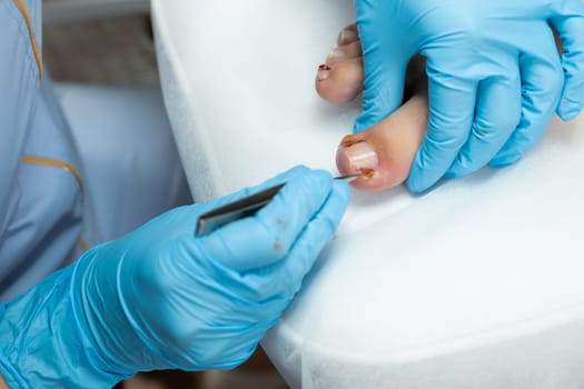 Podologist making medical pedicure in beauty salon