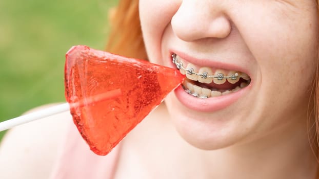 Beautiful young woman with braces on her teeth eats a watermelon-shaped lollipop outdoors