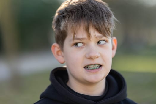 A boy with braces is wearing a black hoodie. He has a serious expression on his face