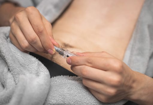Step 3.Hands of a young caucasian man in a gray robe with a bared belly are holding an opening syringe with a medicinal liquid for an injection,lying on a bed,side view close-up.Concept step by step instructions for making an injection.