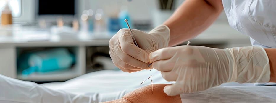 doctor's hands knee acupuncture procedure. selective focus. medical.