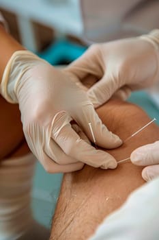 doctor's hands knee acupuncture procedure. selective focus. medical.