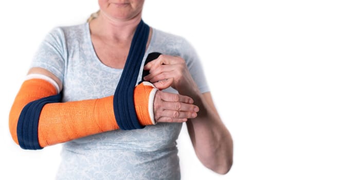 middle aged woman with broken arm in cast hangs her arm in a sling, modern treatment methods, on a neutral background, copy space, high quality photo