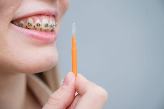 Unrecognizable Caucasian woman cleans braces with a brush. Close-up of female teeth with brackets.