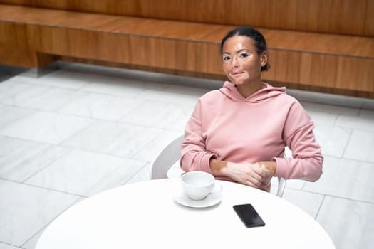 Black african american woman with vitiligo pigmentation skin problem indoor dressed pink hoodie sitting table using smartphone high angle view looking at camera smile