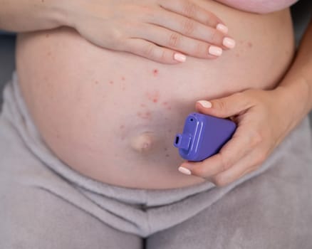 A pregnant woman smokes a vape while sitting on the couch. Close-up of the belly with allergies