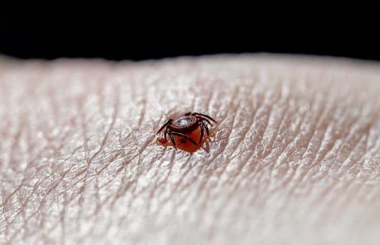 One small tick burrowed into the skin of a Caucasian man on the leg on a summer day, close-up side view.