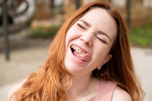 Young woman with braces on her teeth smiles and shows her tongue outdoors