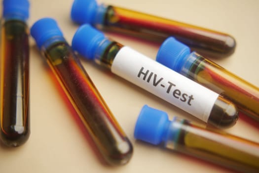 HIV blood test tube on color background .