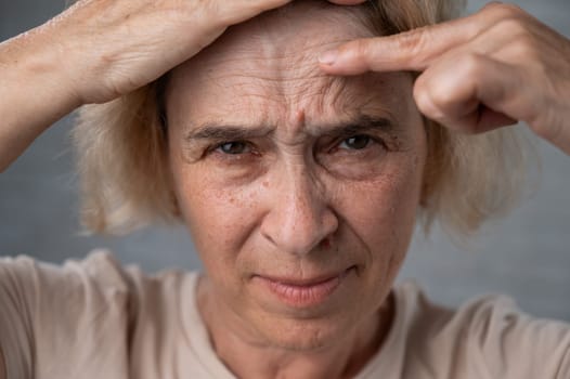 Unhappy elderly woman pointing at wrinkles on her forehead