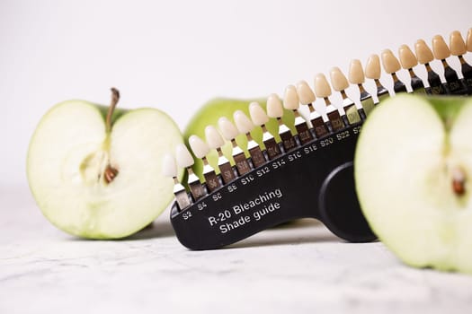 Color scale of teeth cosmetic dentistry. Scale and green apples.