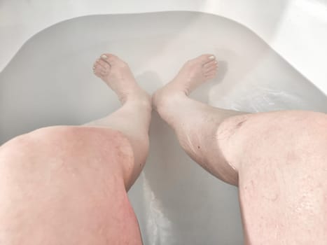 Close-Up of Varicose Veins on a Leg in the Bathtub. Leg with varicose veins while submerged in bathtub, highlighting the health condition