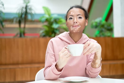 Black african american woman with vitiligo pigmentation skin problem indoor dressed pink hoodie drink tea white mug