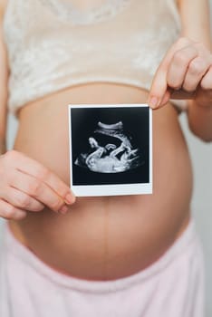 ultrasound picture in the hands of a pregnant girl on the background of the abdomen