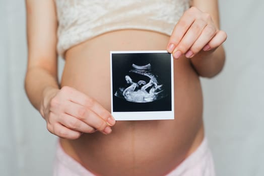 ultrasound picture in the hands of a pregnant girl on the background of the abdomen