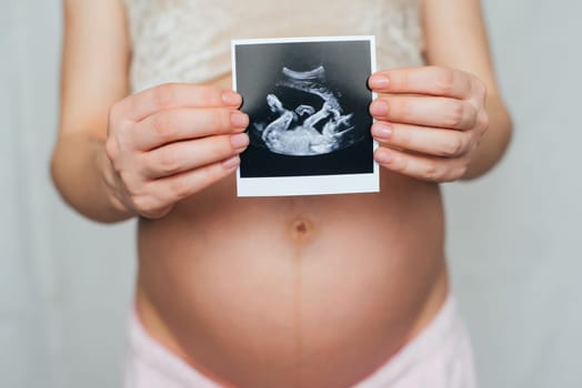 photo ultrasound in the hands of a pregnant young girl on a belly background