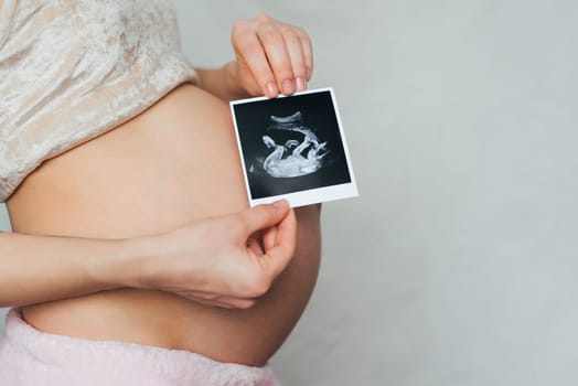 photo ultrasound in the hands of a pregnant young girl on a belly background