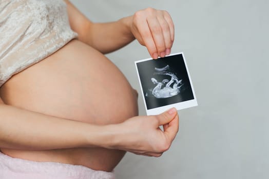 photo of a pregnant ultrasound in the hands of a pregnant girl on the background of the abdomen