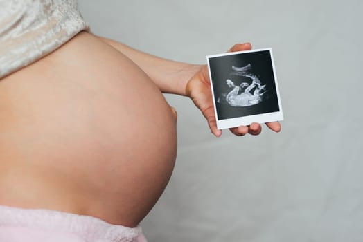 photo ultrasound in the hands of a pregnant young girl on a belly background