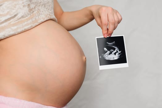 photo of a pregnant ultrasound in the hands of a pregnant girl on the background of the abdomen